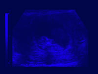 ultra sound scan - powerpoint backgrounds